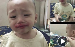 Các mẹ bỉm sữa giật mình khi nhìn thấy em bé miệng toe toét đỏ, nhưng sự thật khiến ai cũng bò lăn ra cười
