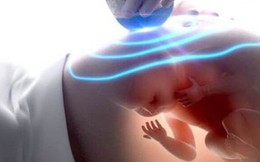 Bác sĩ nói thai nhi chết lưu, mẹ nhất định không tin đòi siêu âm lại và nhận được kết quả hoàn toàn khác