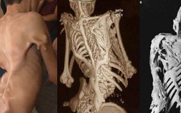 10 căn bệnh kinh dị nhất thế giới, số 1 khiến bạn "nổi da gà" vì quá đáng sợ