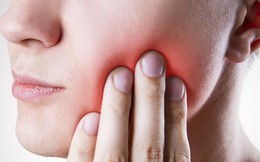 6 dấu hiệu cho thấy bệnh cảm lạnh đã chuyển biến thành viêm xoang