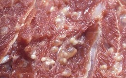 Không có ý nghĩa điều trị, vì sao vẫn để hàng ngàn trẻ xét nghiệm Elisa tìm sán lợn?