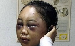 Sốc trước nạn bạo hành người giúp việc ở các quốc gia châu Á: Bỏ đói đến chết, đánh đập tàn nhẫn