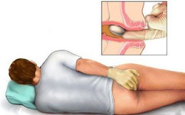 Căn bệnh hay mắc sau tuổi 30, nhiều người nhầm tưởng ung thư: Chuyên gia chỉ cách nhận biết