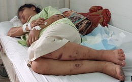 Vụ tra tấn khiến bà bầu bị sảy thai: Người vứt thai nhi đưa 40 triệu xin nạn nhân không làm to chuyện?