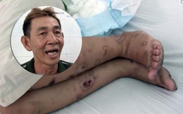 Vụ bà bầu bị tra tấn hơn 20 ngày khiến sảy thai: Nguyên nhân vì món nợ chưa đến 2 triệu đồng