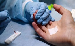 Chưa tạm giữ nghi phạm tấn công 10 người dân TP.HCM phải điều trị phơi nhiễm HIV