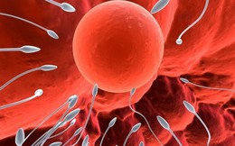 4 yếu tố có thể khiến tinh trùng bất thường, dị dạng: Mọi nam giới đều nên biết để tránh