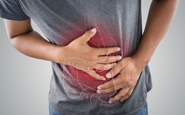 Các cơn đau quặn bụng có phải triệu chứng điển hình của bệnh đại tràng co thắt?