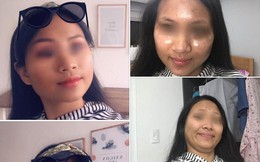Đăng ảnh trước và sau chỉnh sửa, cô gái tự dìm mình để chứng minh: Dù mắt tinh cũng đừng tin ảnh gái trên mạng