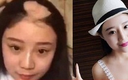 Mỹ nữ hói đầu vì ăn ngô bằng máy khoan khiến cư dân mạng bất ngờ trước diện mạo và cuộc sống hiện tại