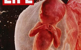 Câu chuyện chưa kể phía sau bức ảnh bào thai 18 tuần tuổi vào 5 thập kỉ trước, làm thay đổi thế giới với sức lan tỏa không tưởng
