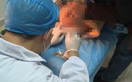 Phát hiện máu trên quần con trai, bố mẹ sợ hãi đưa đến bệnh viện kiểm tra, bác sĩ nói một câu: 'Đó là thảm họa của đồ ăn vặt'