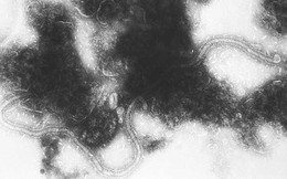 Nhà khoa học Chile tìm ra vắcxin chống virus gây viêm phổi cấp