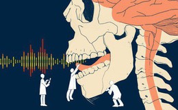 Các nhà khoa học đã có thể mô phỏng giọng nói bằng tín hiệu não