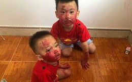 Sự im ắng khác thường trong phòng và 2 cậu con trai mặt mũi bê bết vết đỏ khiến mẹ trẻ đứng hình, cười trong nước mắt