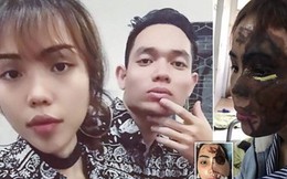 Dân mạng nước ngoài bày tỏ sự thương cảm với cô gái Việt Nam bị chồng sắp cưới tạt axit đến biến dạng khuôn mặt