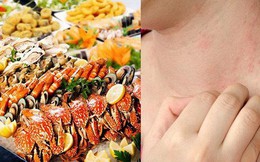 Dị ứng hải sản vì sao, chữa trị thế nào?