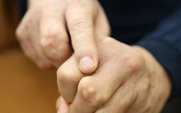 9 nguyên nhân làm tăng nguy cơ mắc bệnh gút