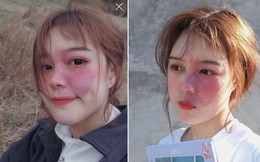 Hot girl với vết chàm lớn trên mặt trở thành mẫu lookbook nổi tiếng: Con gái xinh nhất khi tự tin là chính mình!