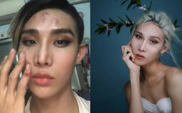 Bị tố hành hung người mẫu lưỡng tính 'The Face', tài xế GoViet thanh minh: Do khách chửi và đánh tôi trước!