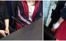 Tìm việc làm trên mạng, nữ sinh viên năm tư phải cắt cổ tay của chính mình chỉ vì một nguyên nhân đáng sợ