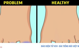 6 dấu hiệu bất thường ở chân cảnh báo bệnh nguy hiểm
