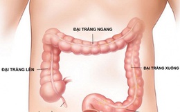 Người bệnh viêm đại tràng mạn tính tránh ăn gì?