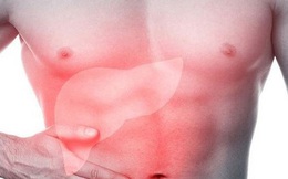 Phó chủ tịch Hội gan mật: Dấu hiệu cảnh báo lá gan kêu cứu ngày Tết