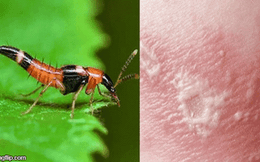 1001 thắc mắc: Loài kiến nào có nọc độc gấp 12 lần nọc rắn hổ mang?