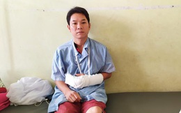 Thiếu tá công an bị con nghiện chém đứt gân tay