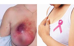 "Dính" 6 thói quen làm tăng nguy cơ ung thư vú: Thói quen thứ 6 rất nhiều phụ nữ mắc