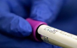 Thị trường thiết bị xét nghiệm kháng thể tại Mỹ: Sự vô lương tâm lên ngôi trong mùa COVID-19?