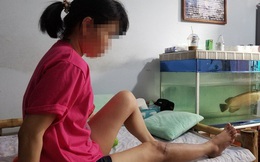Đà Nẵng: Điều tra vụ kế toán trưởng bị nam quản lý đánh gãy chân