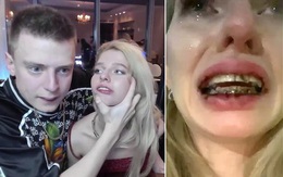 Mẫu nữ bị đánh đập dã man đến gãy cả niềng răng khi đang livestream trên kênh YouTube có gần 700 nghìn subscriber