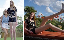 Sở hữu đôi chân dài hơn 1m3, cô bé 17 tuổi khiến ai đứng gần cũng phải e dè vì sợ biến thành 'chú lùn'