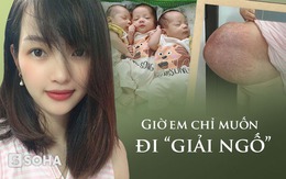 Cô gái trẻ sinh 3 với chiếc bụng rạn "nổi tiếng": Nỗi lo cơm áo và những điều vượt quá tưởng tượng