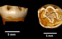 Chiếc răng lạ tiết lộ đứa trẻ y hệt nhưng không phải loài người chúng ta