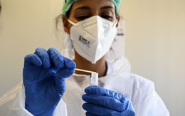 Hơn 53,7 triệu ca mắc Covid-19 trên thế giới, Mỹ liên tiếp chứng kiến kỷ lục “sốc"