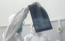 Bệnh nhân Covid-19 tái dương tính với SARS-CoV-2, sốt 39 độ C sau gần 2 tháng xuất viện