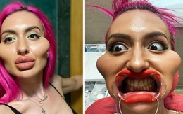 Cô gái với 'cặp má lớn nhất thế giới' từng gây tranh cãi trên MXH khiến dân tình tiếc hùi hụi khi lộ ảnh chân dung trước đây