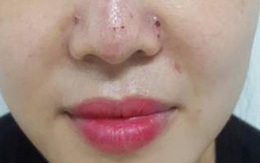 Hàng trăm ca biến chứng làm đẹp từ các cơ sở 'chui' mỗi tháng