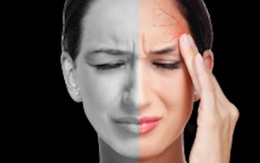 Chánh niệm có thể giúp giảm đau nửa đầu