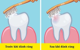 Các nha sĩ trả lời câu hỏi "dễ mà khó": Nên đánh răng trước hay sau bữa ăn sáng?