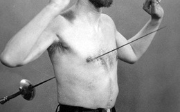 Tấm X-quang và sự thật về người 500 lần kiếm xuyên ngực không chết