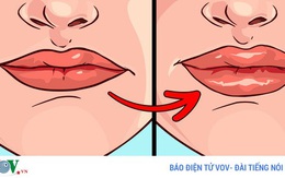 8 dấu hiệu của đôi môi tiết lộ tình trạng sức khoẻ của bạn