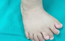 Kỳ lạ một bé trai có tới 9 ngón chân
