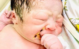 Sự thật về bé sơ sinh đẻ ra cầm trên tay chiếc vòng tránh thai
