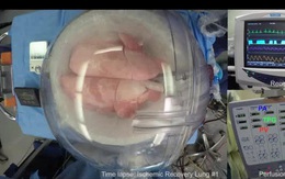 Đột phá: Phổi người tổn thương được chữa lành sau 24 giờ nối vào cơ thể lợn