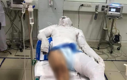 Chủ nợ chặn "con nợ" giữa đường đổ xăng lên người châm lửa đốt