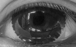 Chọn ánh mắt tuyệt vọng nhất, câu trả lời sẽ tiết lộ bạn là người thế nào trong tình yêu, hay bắt nạt người yêu hay ngoan ngoãn